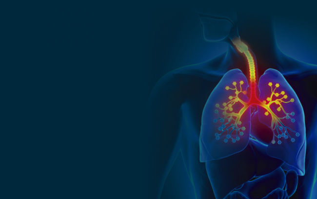 LowRes_Respiratory_Distress_Poster_A3_24